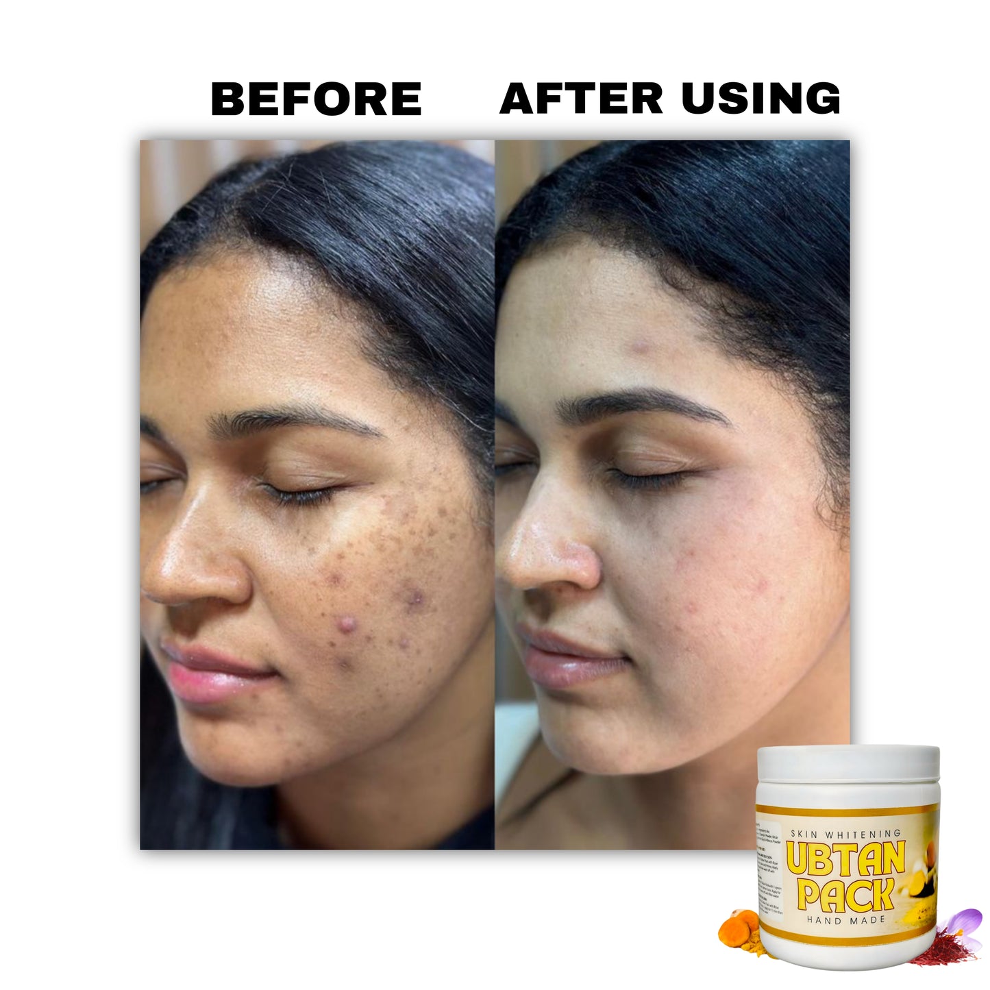 Get Glowing & Clear Skin in Just 10 Minutes – 100% Natural Ubtan Formula